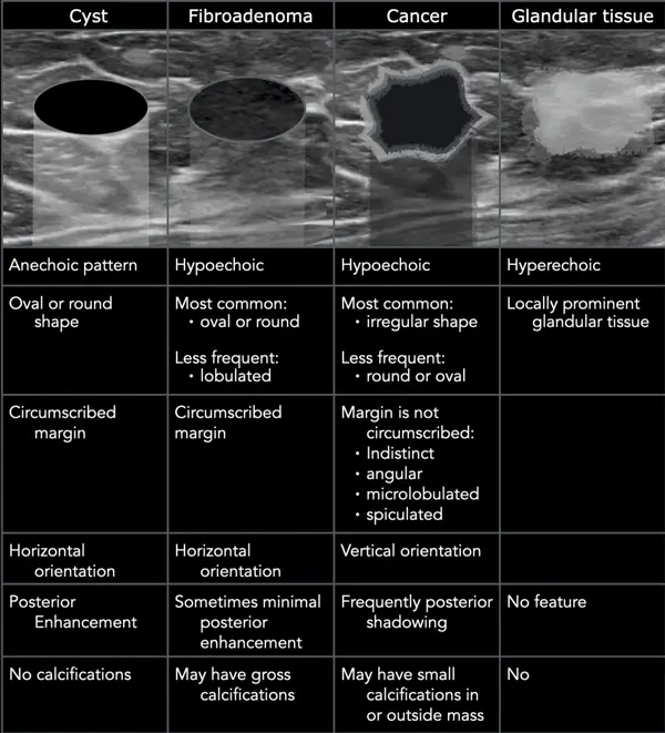 Breast ultrasound &#8211; how to interpret the results?