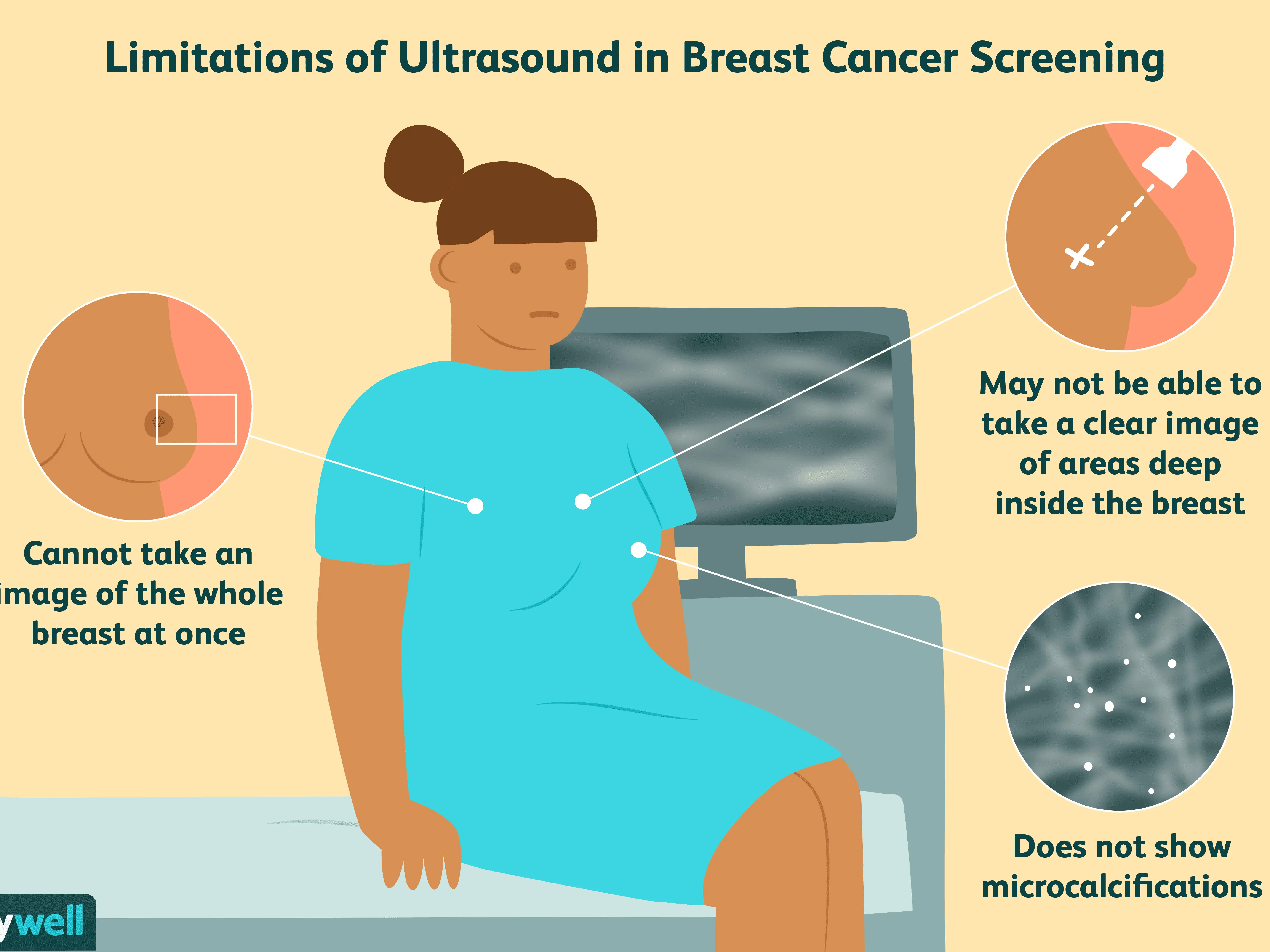 Breast ultrasound &#8211; indications and the course of the examination. How is breast ultrasound different from mammography and biopsy?