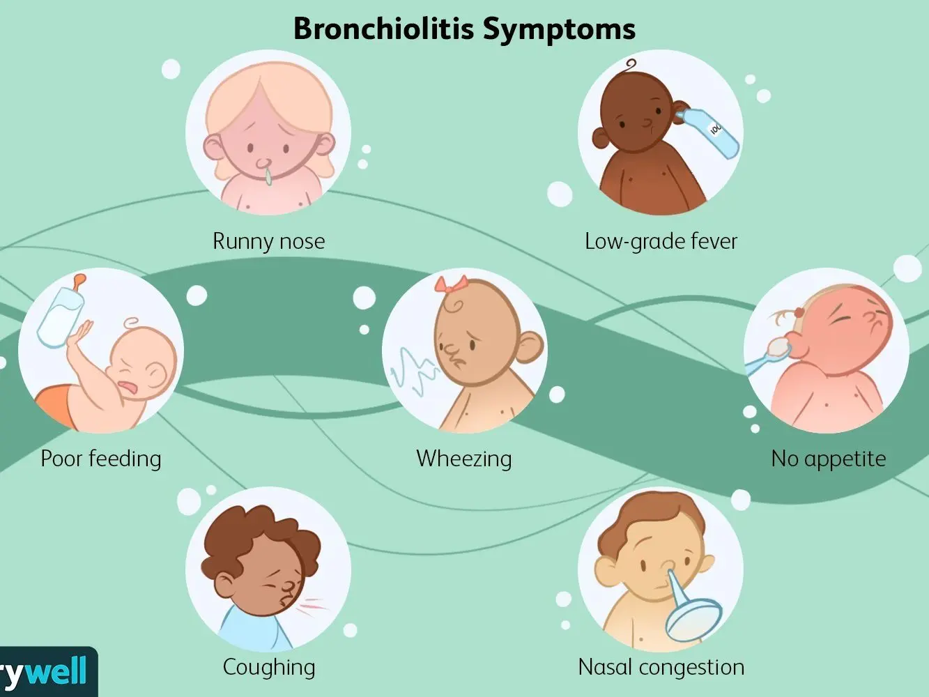 Bronchitis in children &#8211; symptoms, treatment