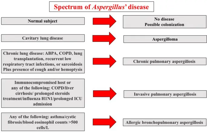 Bronchopulmonary aspergillosis &#8211; symptoms, diagnosis, treatment