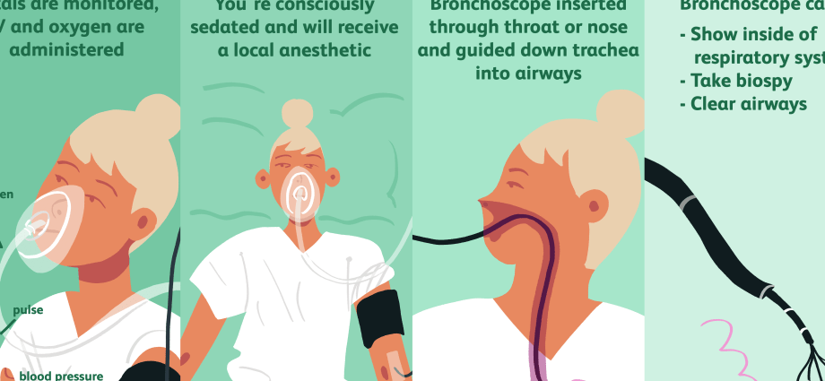 Bronchoscopy &#8211; indications, preparation, course, possible complications