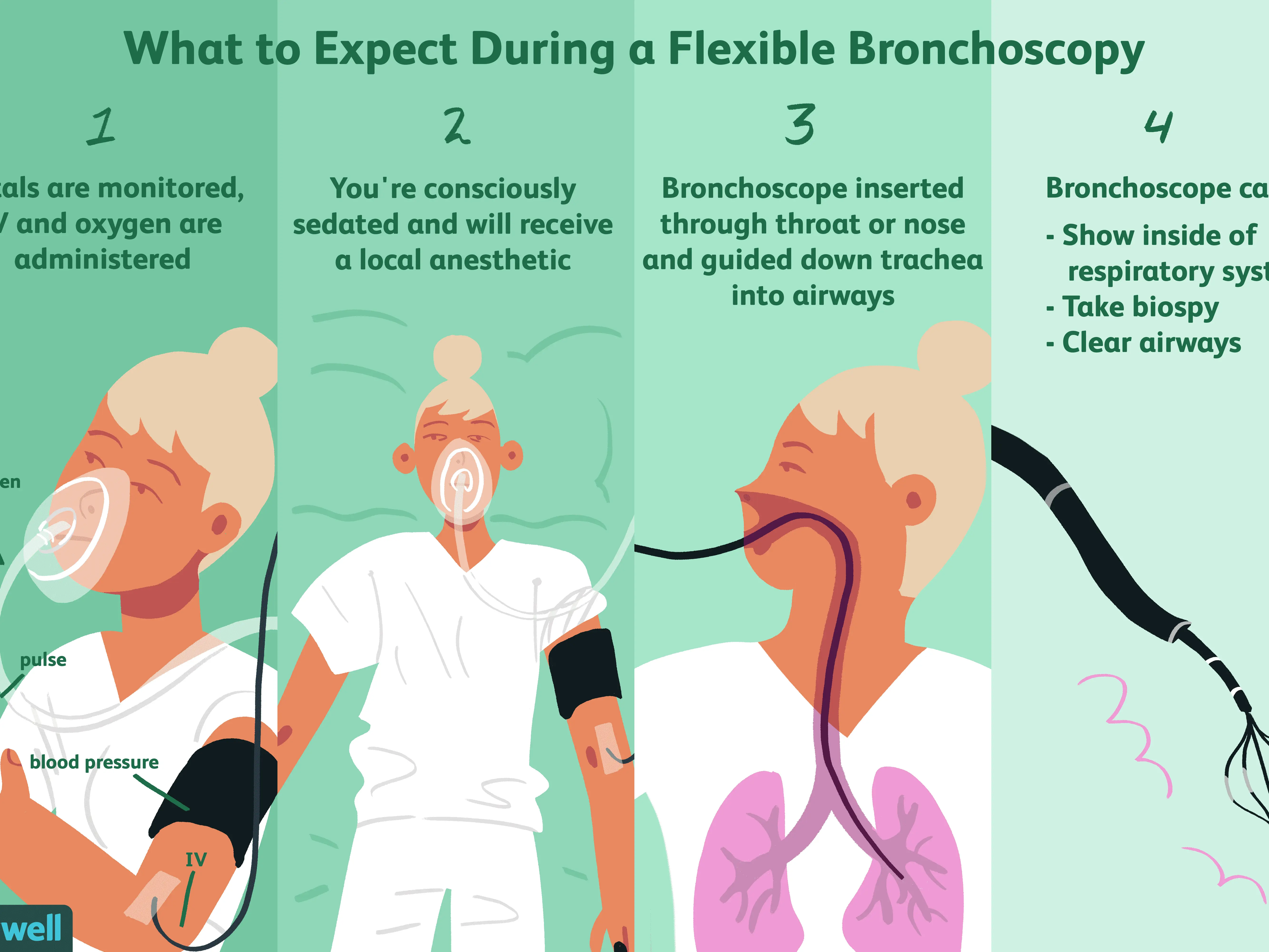 Bronchoscopy &#8211; indications, preparation, course, possible complications