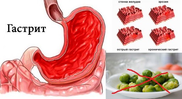 Brussels sprouts: benefits and harms, composition, contraindications