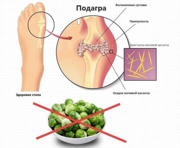 Brussels sprouts: benefits and harms, composition, contraindications