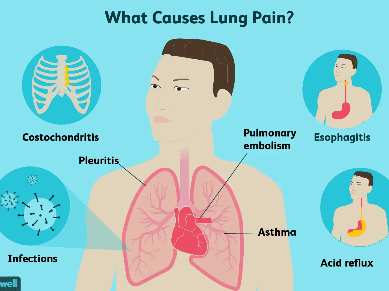 Burning sensation in the chest &#8211; heart or lungs?