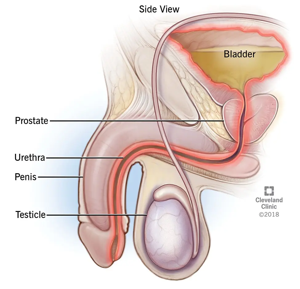 Burning sensation when urinating &#8211; is it a symptom of a disease?