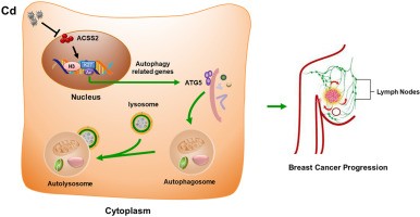 Cadmium may promote breast cancer