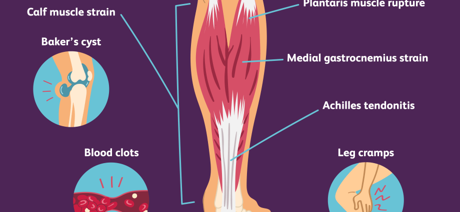 Calf cramps &#8211; what could they be a symptom of the disease?