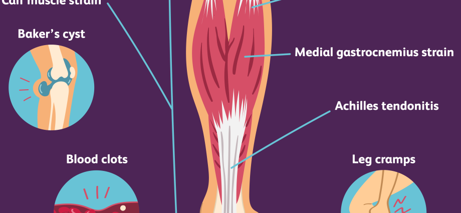 Calf pain &#8211; symptoms, causes, treatment, prognosis