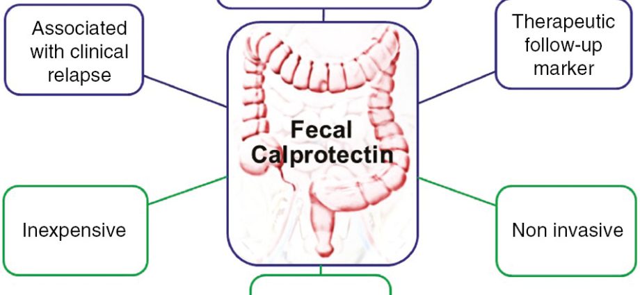 Calprotectin &#8211; indications, standards, the course of the study