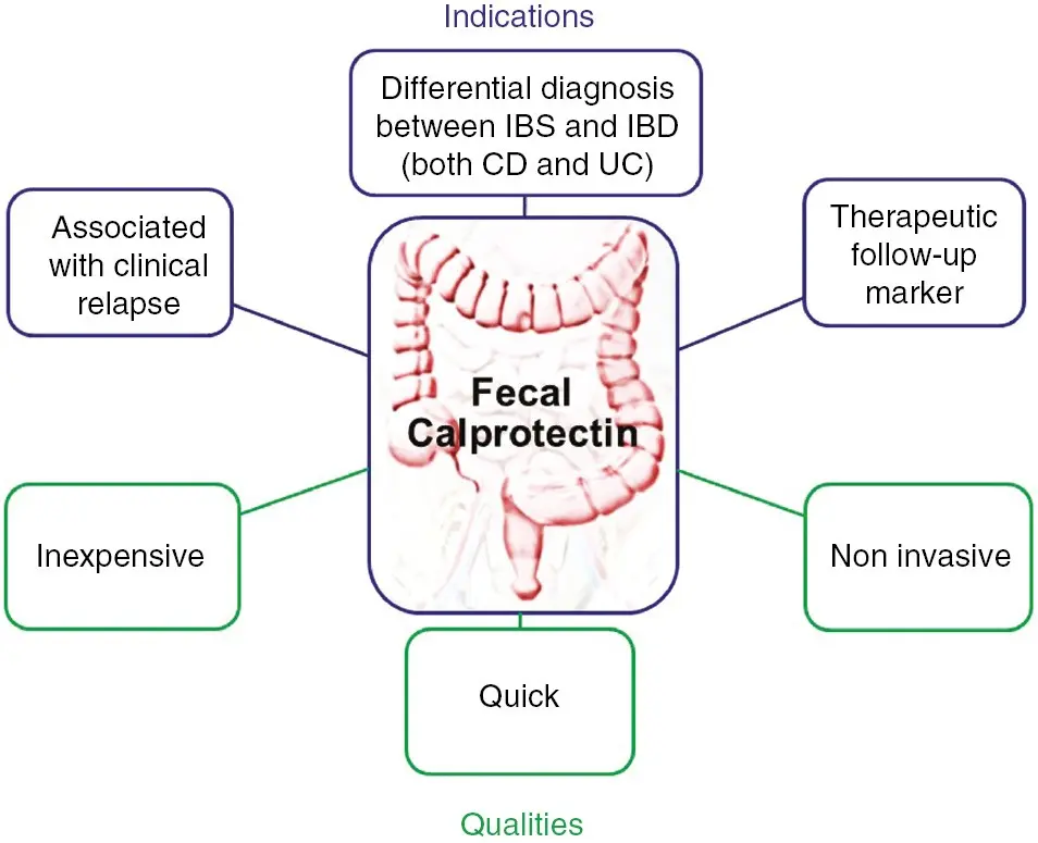 Calprotectin &#8211; indications, standards, the course of the study