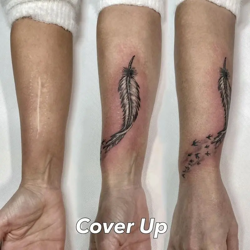 Can a scar be tattooed?