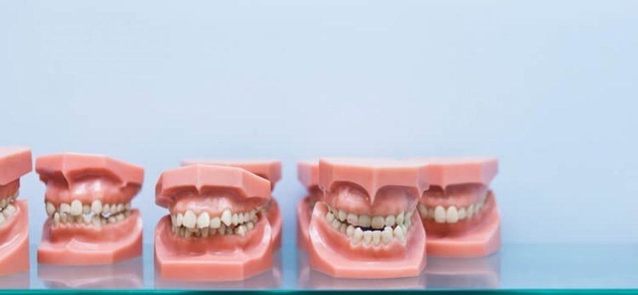 Can anyone wear an orthodontic appliance? The most important information about the treatment of malocclusion