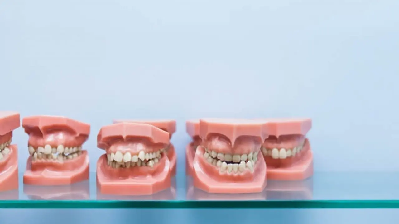 Can anyone wear an orthodontic appliance? The most important information about the treatment of malocclusion