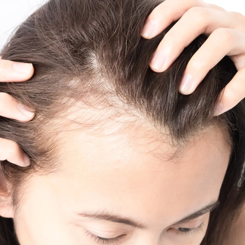 Can my hair hurt? Trichodynia is a real disease and a serious problem