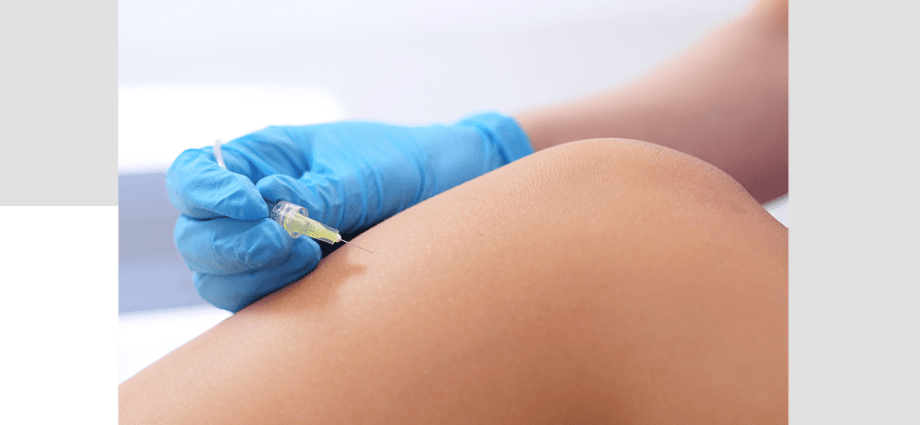 Carboxytherapy &#8211; what is it? Effects of application