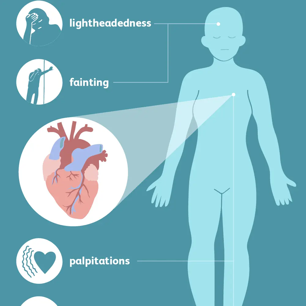 Cardiac arrhythmias &#8211; causes and symptoms. What is the treatment of arrhythmia?