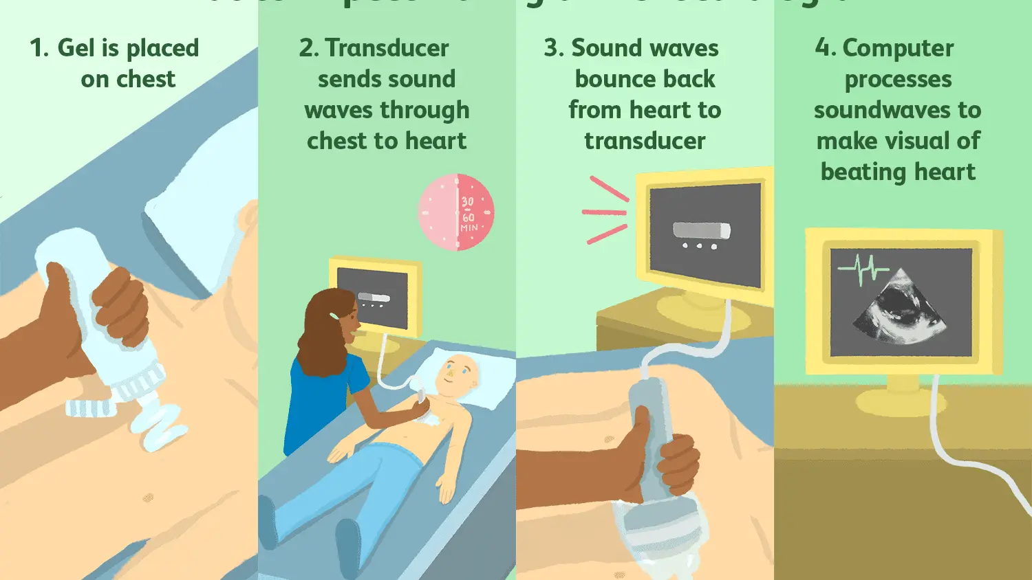 Cardiac echocardiography &#8211; what does it detect and how does it proceed? Types and indications for echocardiography