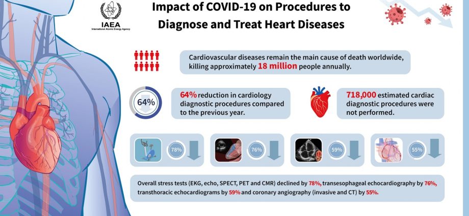 Cardiological diseases during the pandemic. How to take care of your heart without leaving home?