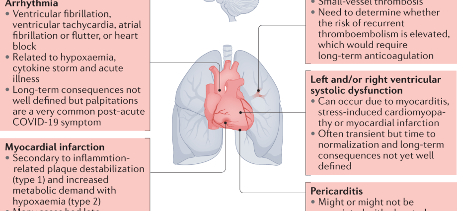 Ahli jantung: komplikasi pascacovid mungkin lebih merupakan masalah daripada penyakit
