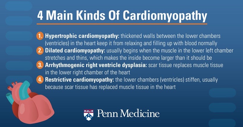 Cardiomyopathy &#8211; types, causes, treatment