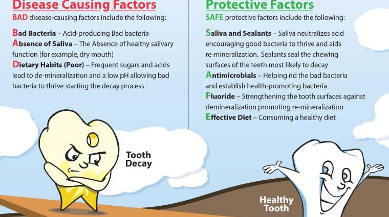 Caries &#8211; causes, risk factors, treatment. How to prevent tooth decay?