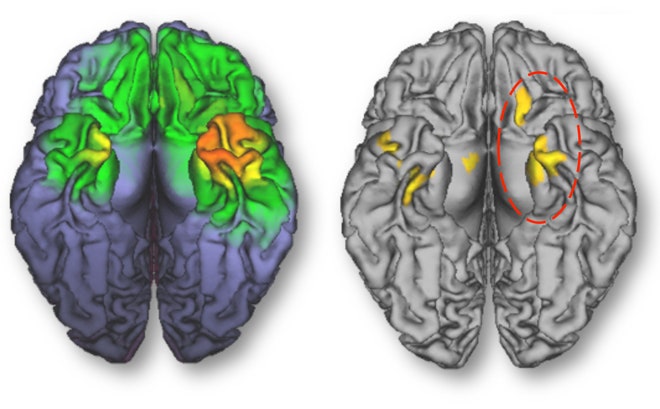 Cell phones increase brain activity