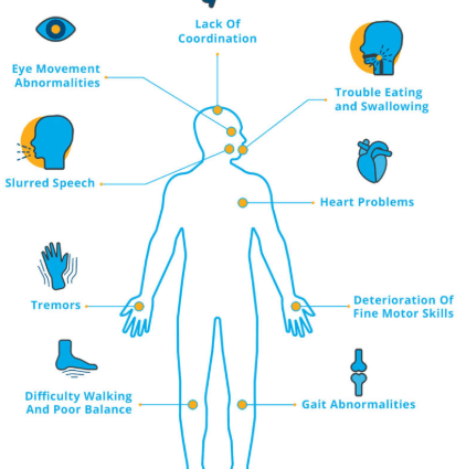 Cerebellospinal ataxia &#8211; symptoms, treatment