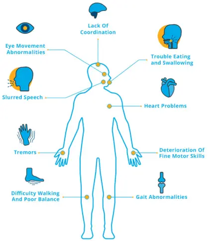 Cerebellospinal ataxia &#8211; symptoms, treatment