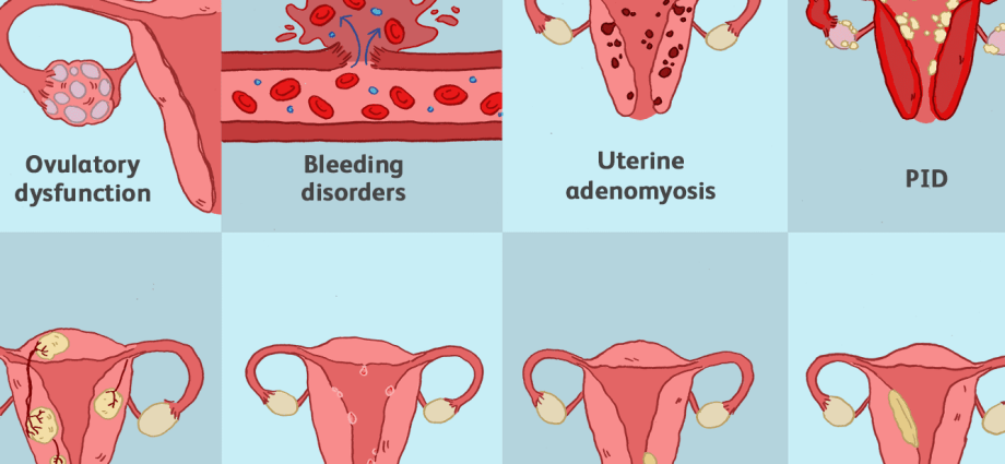 Cervix &#8211; what diseases affect it?