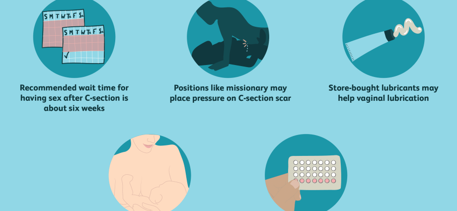 Cesarean section step by step &#8211; preparation, course. What does sexual intercourse after cesarean look like?