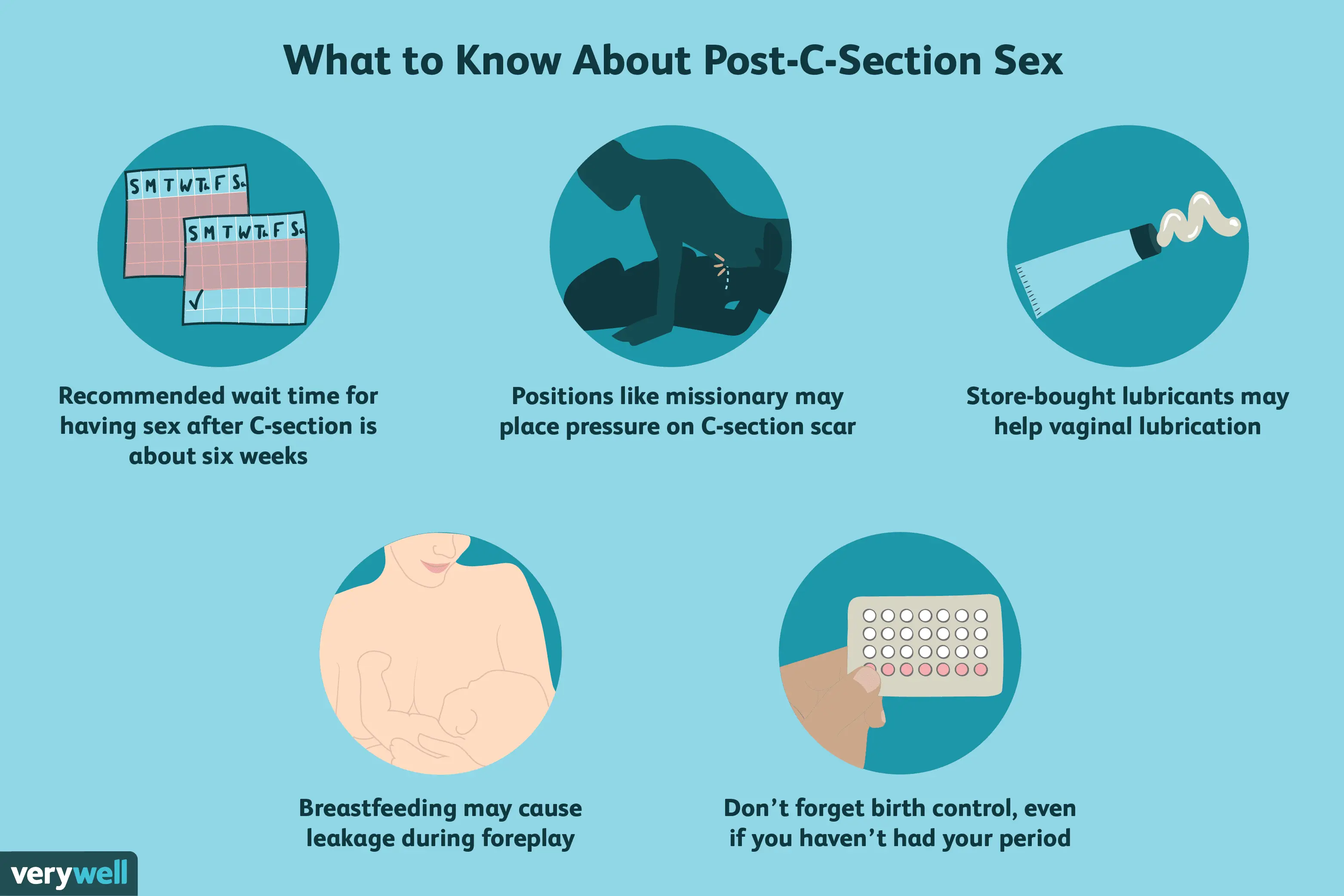 Cesarean section step by step &#8211; preparation, course. What does sexual intercourse after cesarean look like?