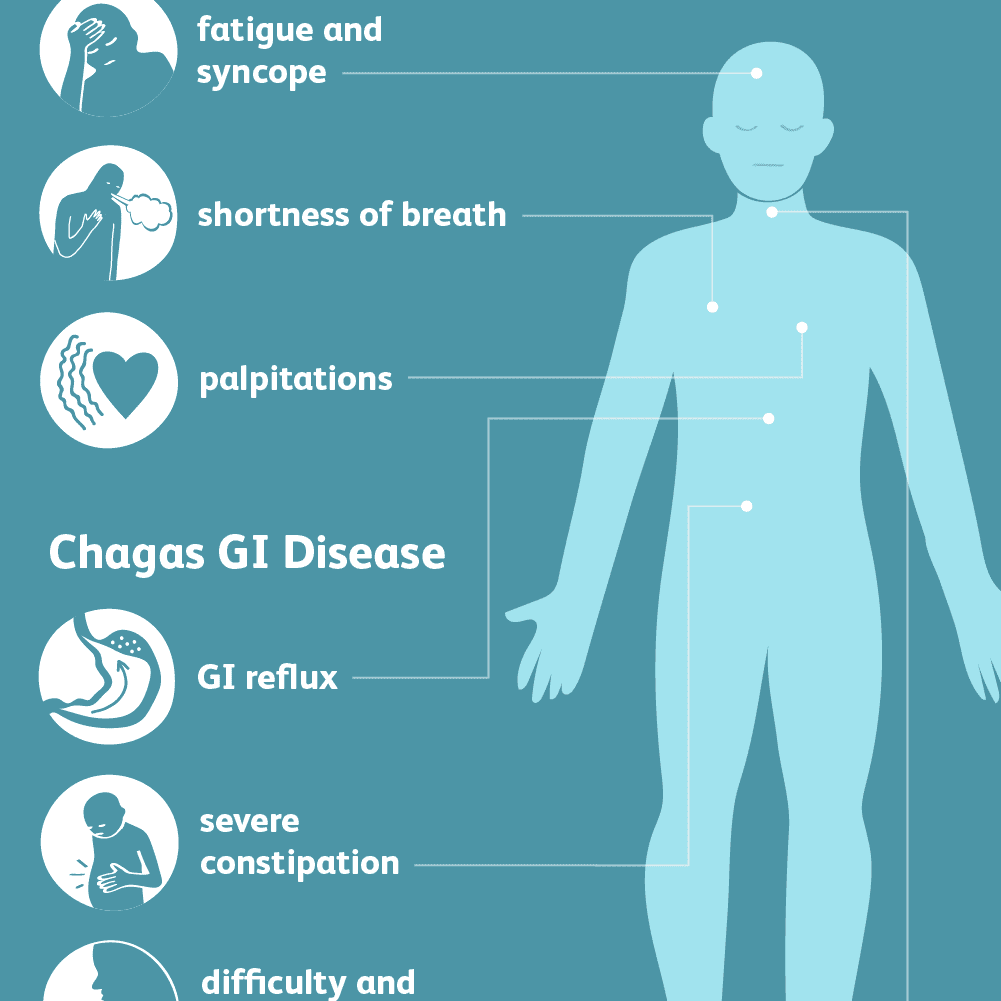 chagas-disease-causes-symptoms-treatment-healthy-food-near-me