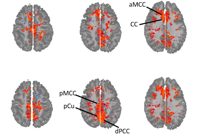 Chemistry that causes autism