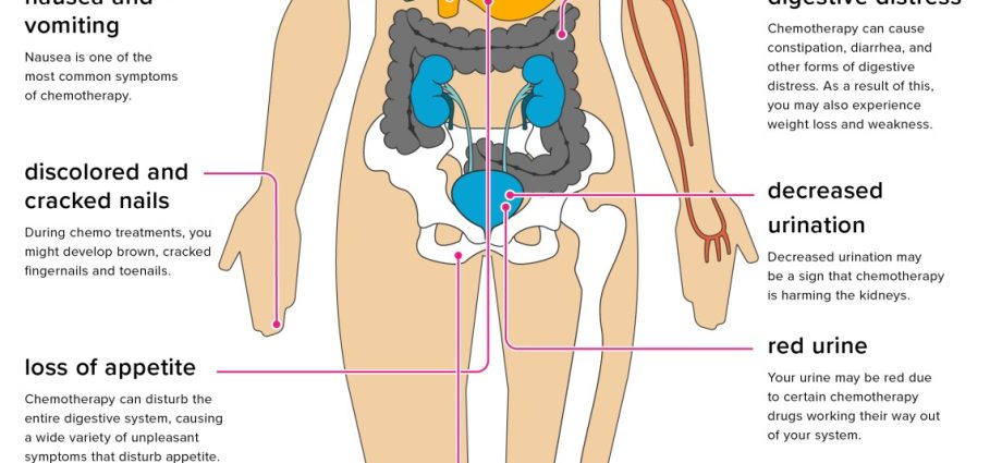 Chemotherapy and its effects on the body