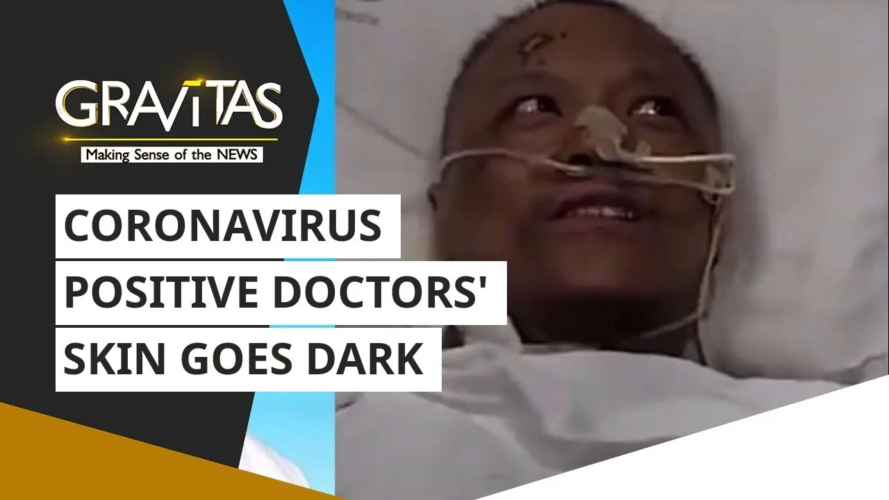 China: The skin of two doctors treated for coronavirus infection has darkened