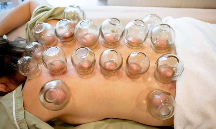 Chinese cupping massage