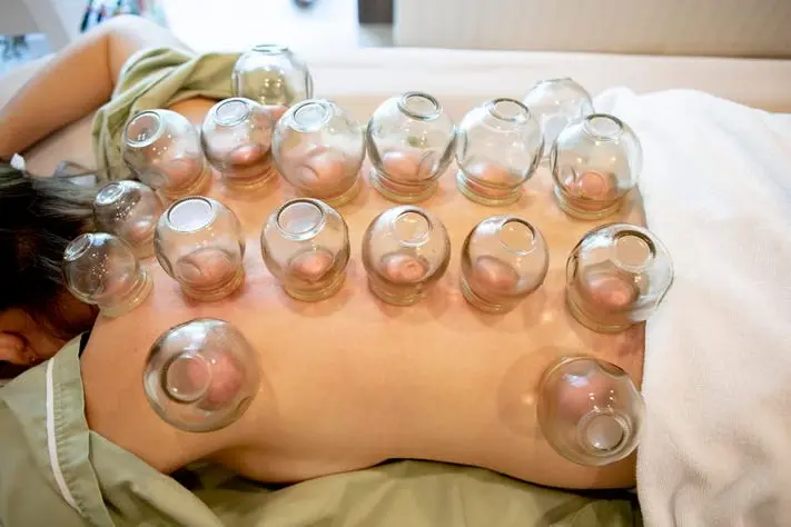 Chinese cupping massage