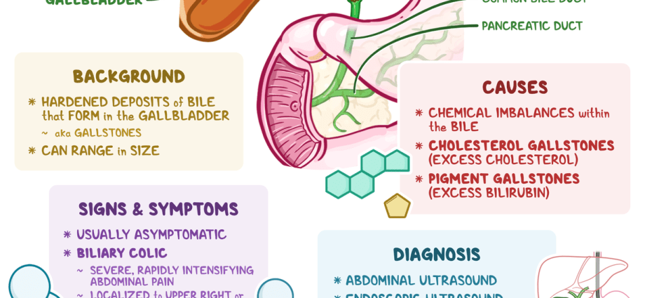 Cholecystitis &#8211; types, treatment