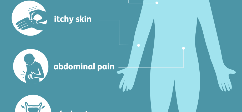 Cholestasis (cholestasis) &#8211; symptoms, treatment