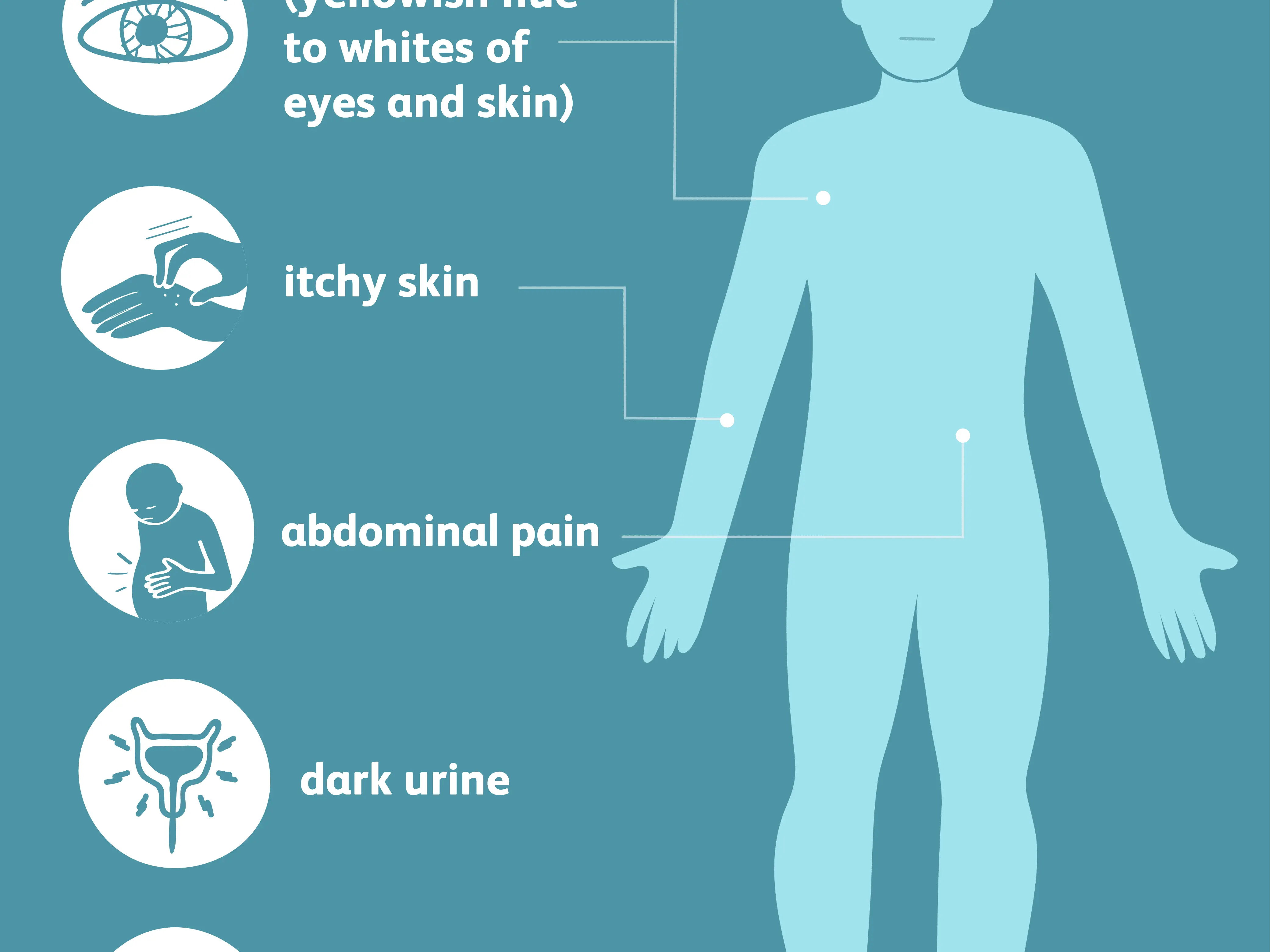 Cholestasis (cholestasis) &#8211; symptoms, treatment