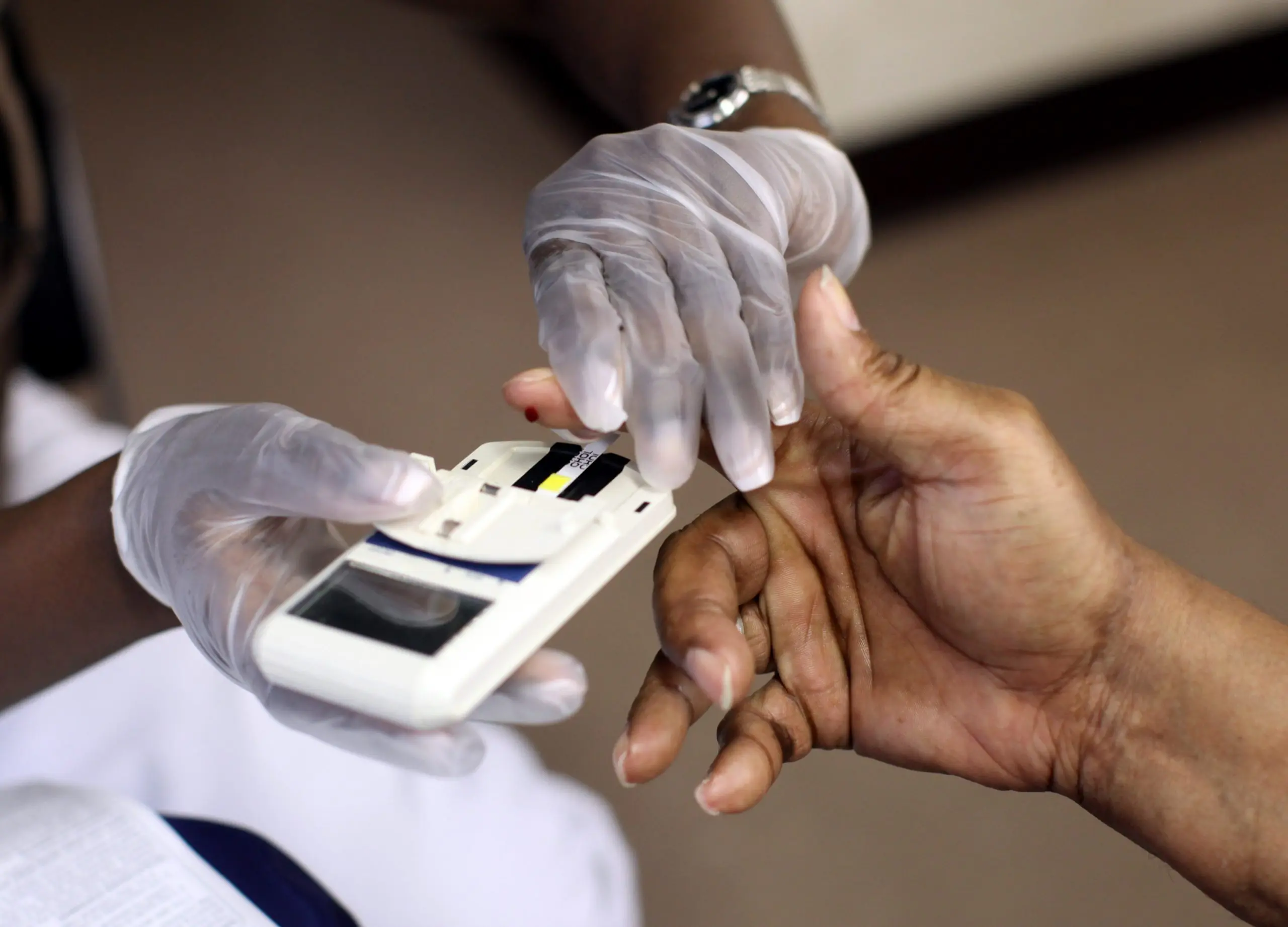 Cholesterol measurement based on a photo of a hand