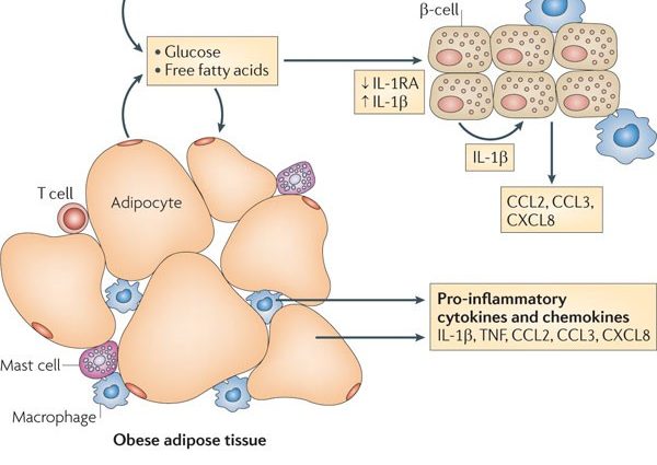 Chronic inflammation can lead to diabetes