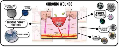 Chronic wounds of the elderly &#8211; where do they come from? Types of chronic wounds [WE EXPLAIN]