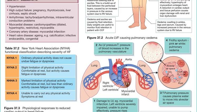 Circulatory failure