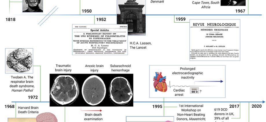 Clinical death neurosurgeon: the brain continues to function for some time