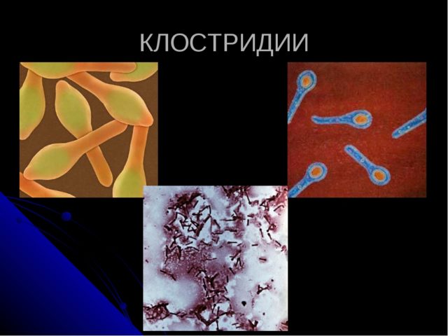 Clostridium in calves and cows