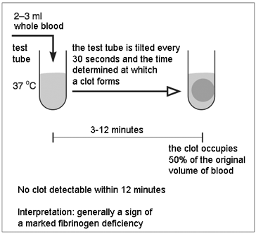 Clotting time &#8211; when to test, what it depends on, analysis of the results