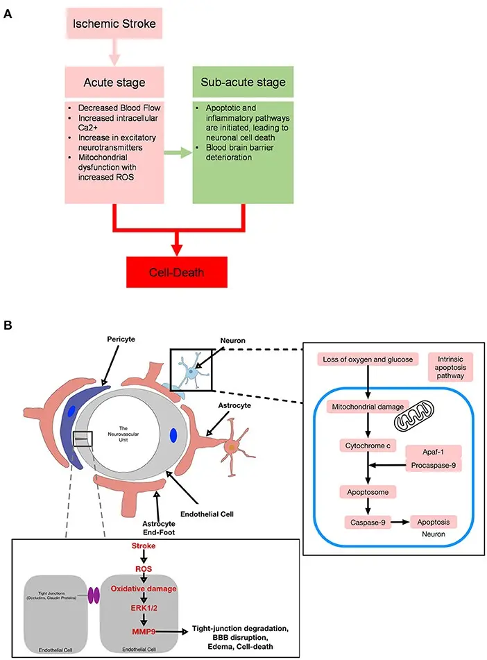 &#8220;Coagulation cascade&#8221;. A neurologist explains why people with COVID-19 often have strokes and strokes