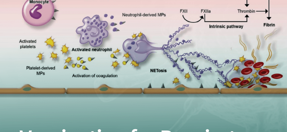 Coexisting diseases of Krzysztof Krawczyk. How could they affect the course of COVID-19?